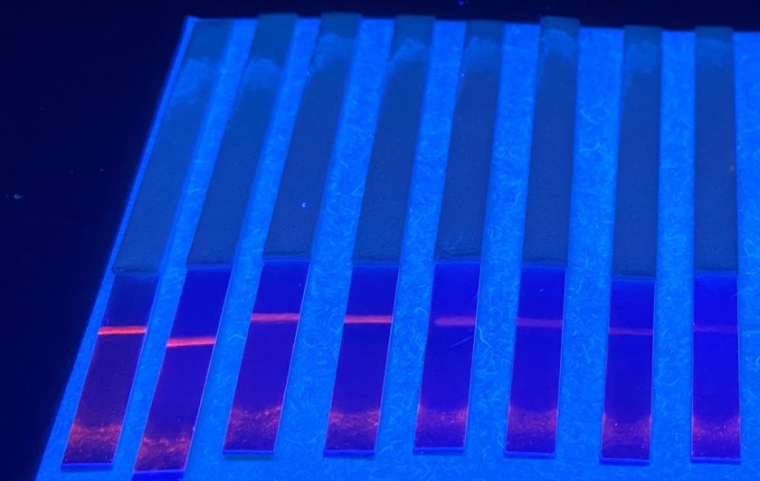 The students use UV light to reveal the GFAP protein in blood. The intensity of the line shows the amount of GFAP present and, in turn, the severity of the brain damage. The students use UV light to reveal the GFAP protein in blood. The intensity of the line shows the amount of GFAP present and, in turn, the severity of the brain damage.