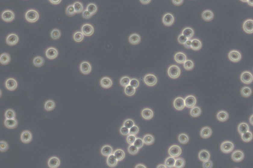 Baker's yeast (Saccharomyces cerevisiae) under the microscope Baker's yeast (Saccharomyces cerevisiae) under the microscope